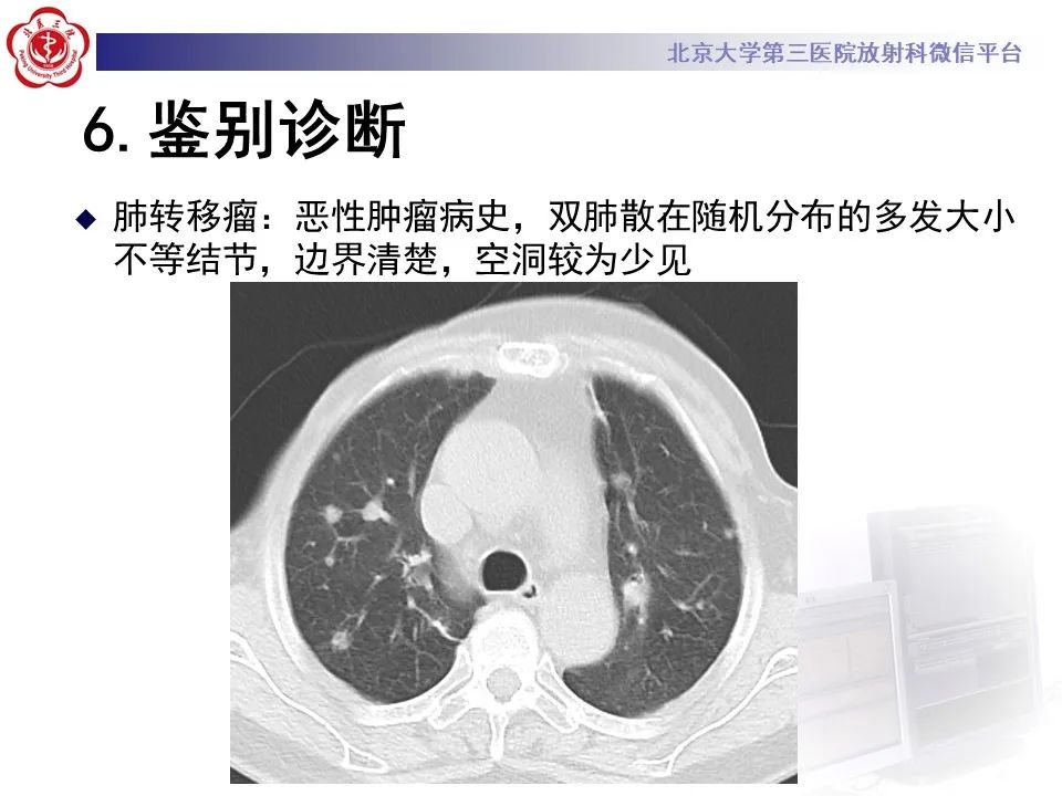 影像PPT - 【PPT】侵袭性念珠菌病肺内播散的影像-24