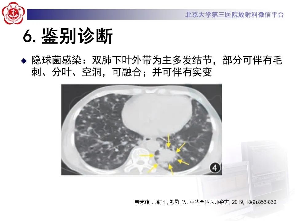 影像PPT - 【PPT】侵袭性念珠菌病肺内播散的影像-27