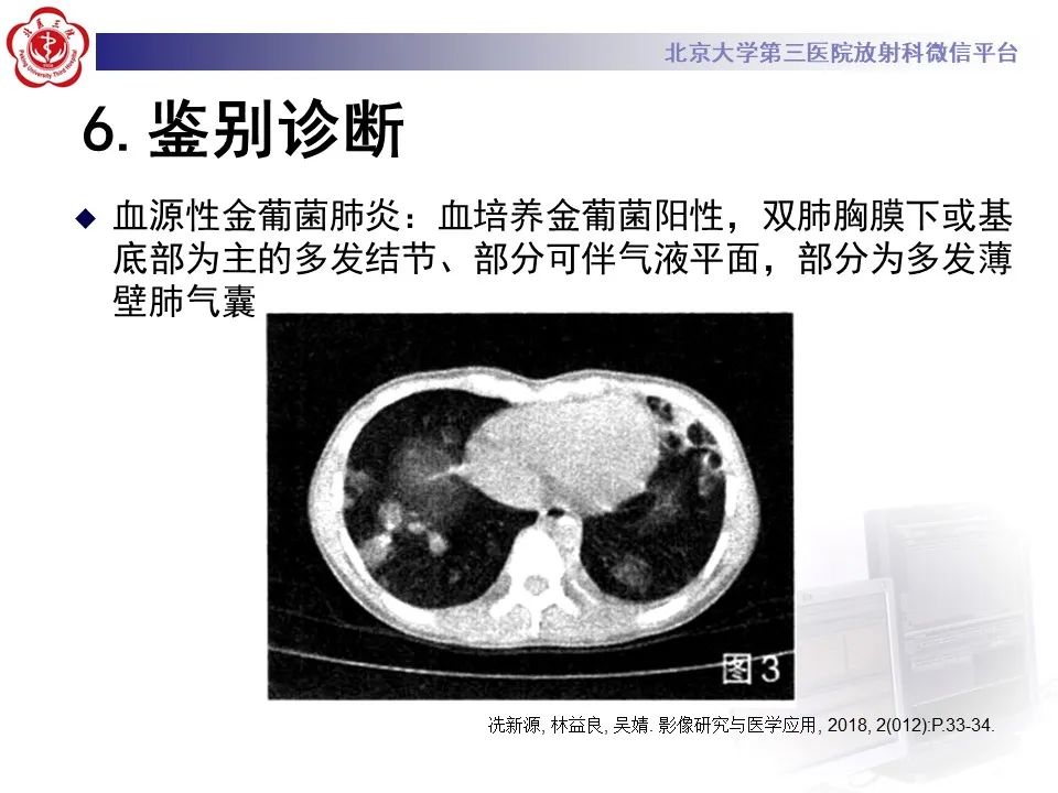 影像PPT - 【PPT】侵袭性念珠菌病肺内播散的影像-25
