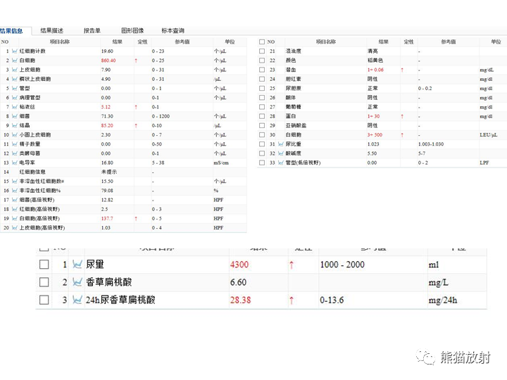 影像PPT - 【病例】腹膜后Castleman病2例CT及MR影像-3