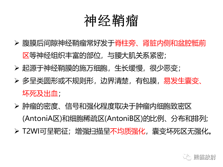 影像PPT - 【病例】腹膜后Castleman病2例CT及MR影像-34