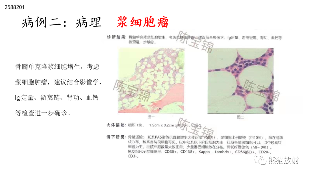 影像PPT - 【病例】股骨纤维肉瘤 VS 胸骨浆细胞瘤-22
