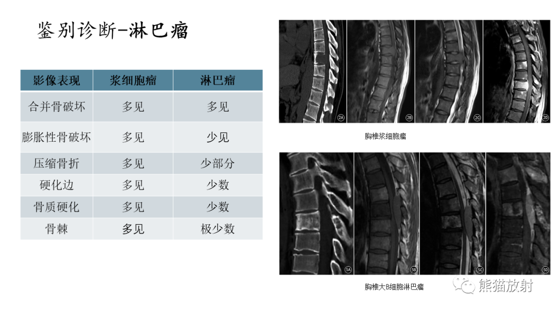 影像PPT - 【病例】股骨纤维肉瘤 VS 胸骨浆细胞瘤-31