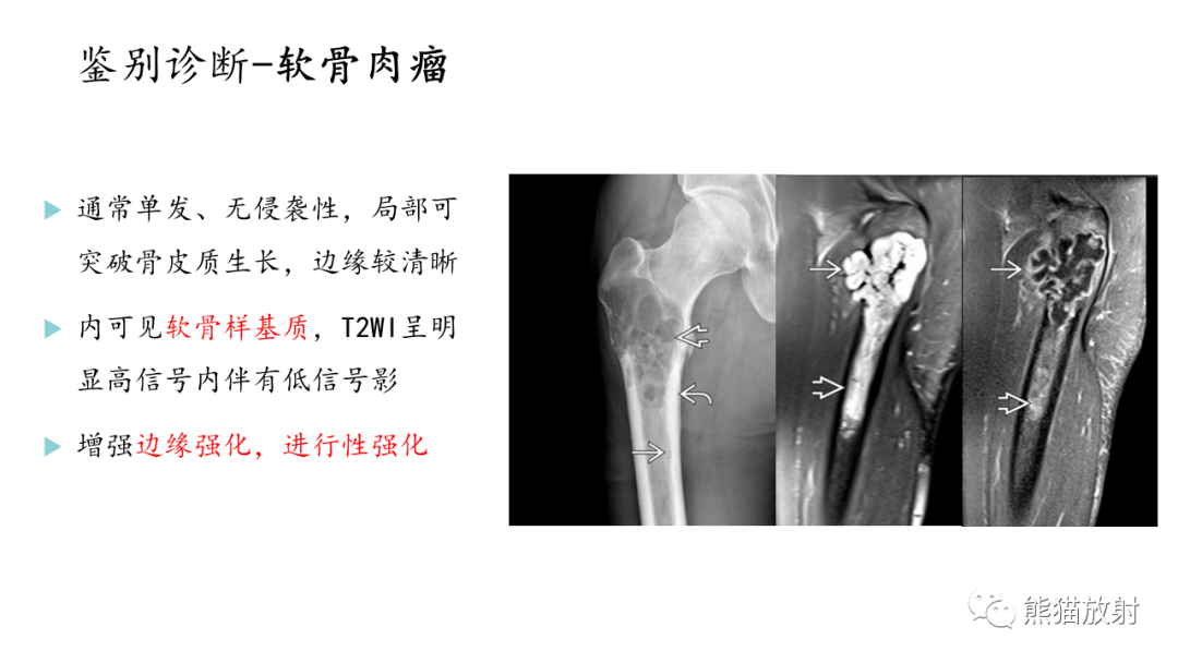 影像PPT - 【病例】股骨纤维肉瘤 VS 胸骨浆细胞瘤-32