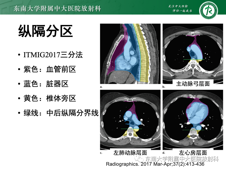 影像PPT - 【PPT】前纵隔淋巴瘤-8
