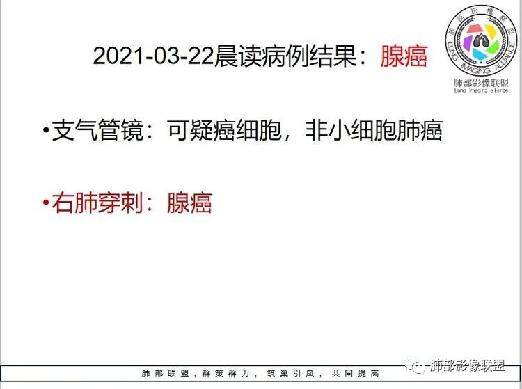 影像PPT - 【病例】单侧蜂窝肺——腺癌1例CT影像-20 影像PPT - 【病例】单侧蜂窝肺——腺癌1例CT影像-20