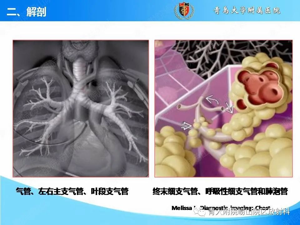 影像PPT - 【PPT】支气管黏液栓塞的影像诊断与鉴别-6
