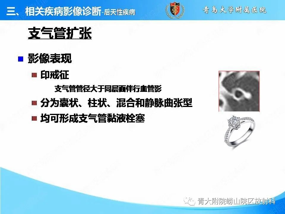 影像PPT - 【PPT】支气管黏液栓塞的影像诊断与鉴别-29