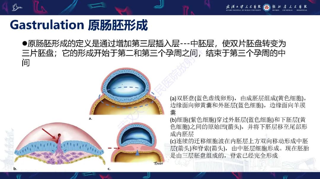 影像PPT - 【PPT】脊柱闭合不全影像诊断-6