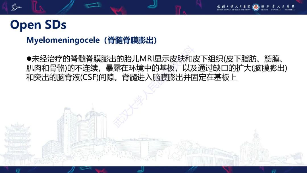 影像PPT - 【PPT】脊柱闭合不全影像诊断-12