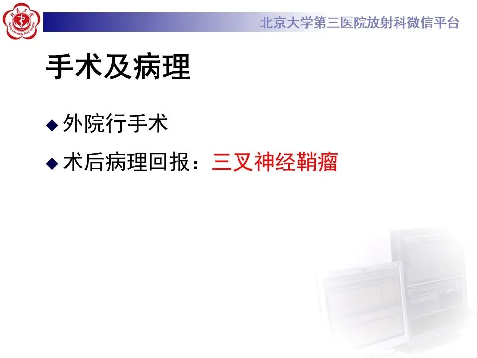 影像PPT - 【PPT】颅内三叉神经鞘瘤-7