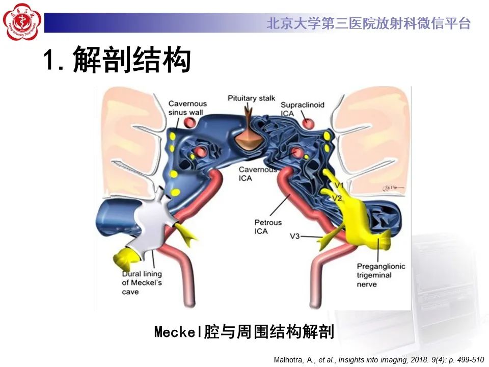 影像PPT - 【PPT】颅内三叉神经鞘瘤-9