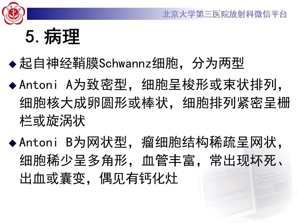 影像PPT - 【PPT】颅内三叉神经鞘瘤-13