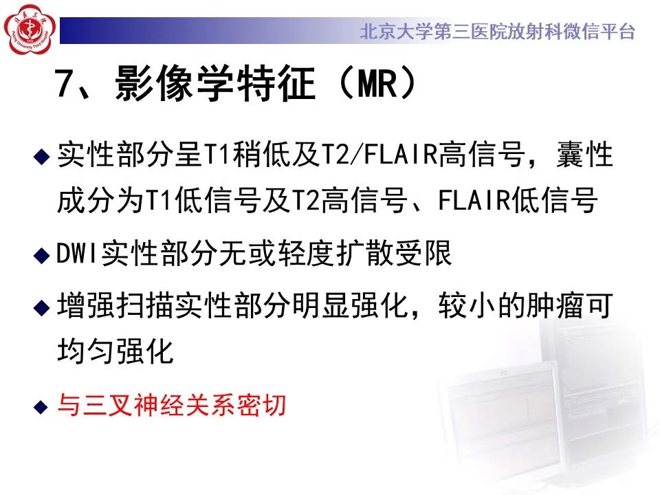 影像PPT - 【PPT】颅内三叉神经鞘瘤-16