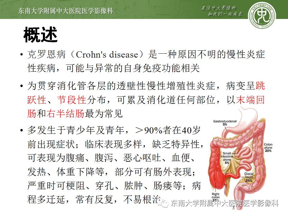 影像PPT - 【PPT】克罗恩病及常见并发症-8