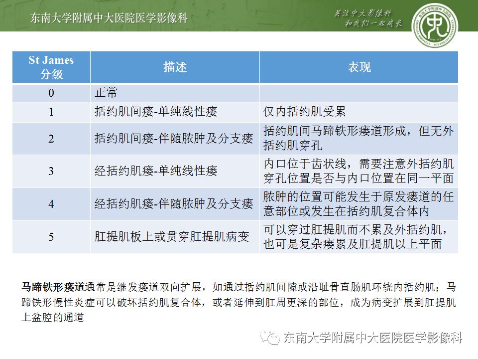 影像PPT - 【PPT】克罗恩病及常见并发症-20