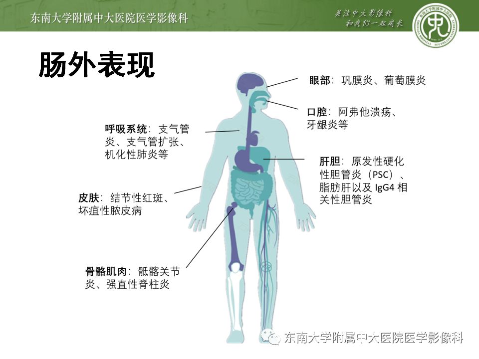 影像PPT - 【PPT】克罗恩病及常见并发症-24