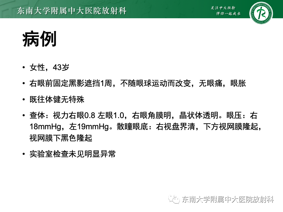 影像PPT - 【PPT】原发性葡萄膜黑色素瘤-3 影像PPT - 【PPT】原发性葡萄膜黑色素瘤-3