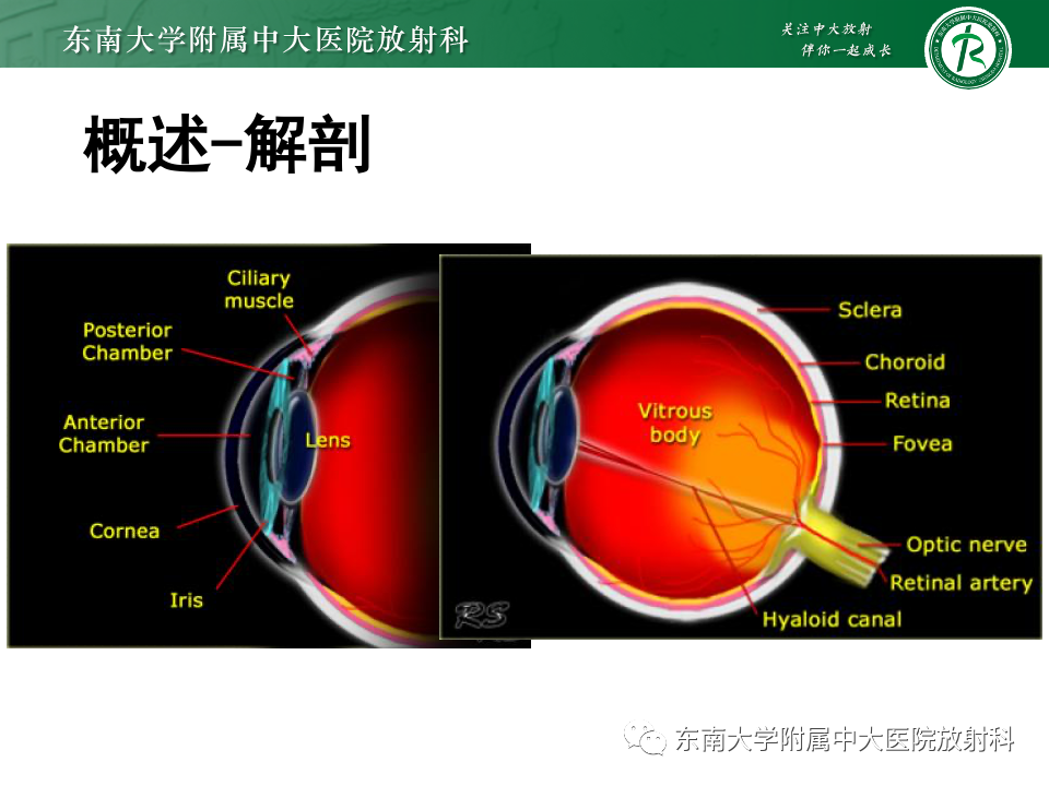 影像PPT - 【PPT】原发性葡萄膜黑色素瘤-7 影像PPT - 【PPT】原发性葡萄膜黑色素瘤-7