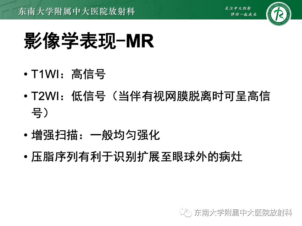 影像PPT - 【PPT】原发性葡萄膜黑色素瘤-13 影像PPT - 【PPT】原发性葡萄膜黑色素瘤-13