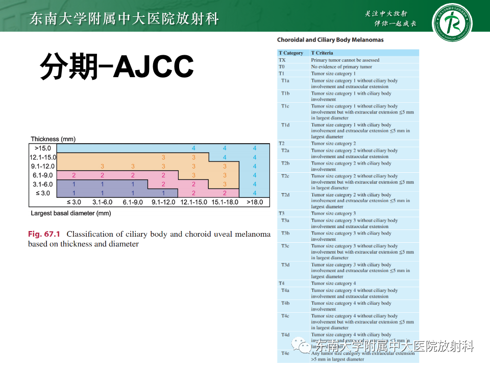 影像PPT - 【PPT】原发性葡萄膜黑色素瘤-28 影像PPT - 【PPT】原发性葡萄膜黑色素瘤-28