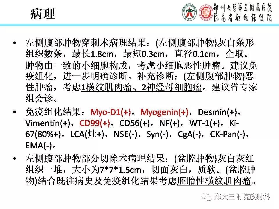 影像PPT - 【PPT】儿童腹盆腔横纹肌肉瘤病例分享-8