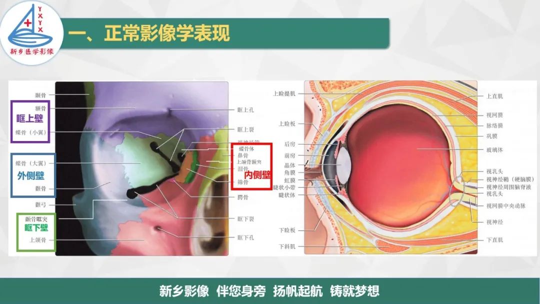 影像PPT - 【PPT】医学影像诊断学教材解读—眼部疾病2-3
