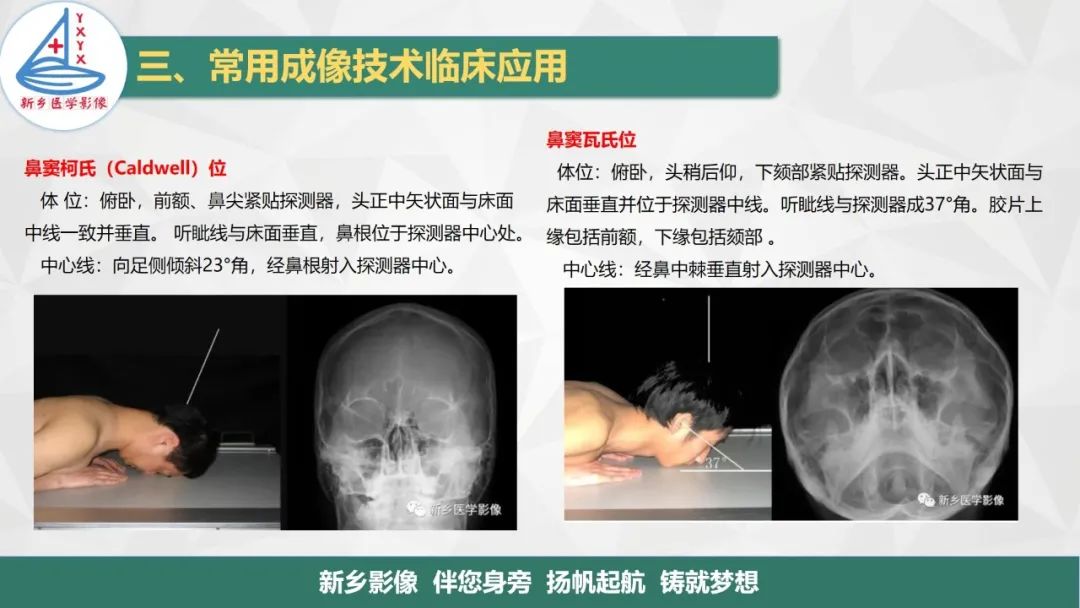 影像PPT - 【PPT】医学影像诊断学教材解读—鼻部疾病-13