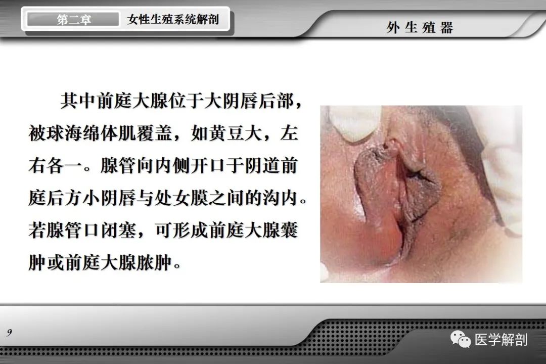 影像PPT - 【PPT】女性生殖系统解剖-8