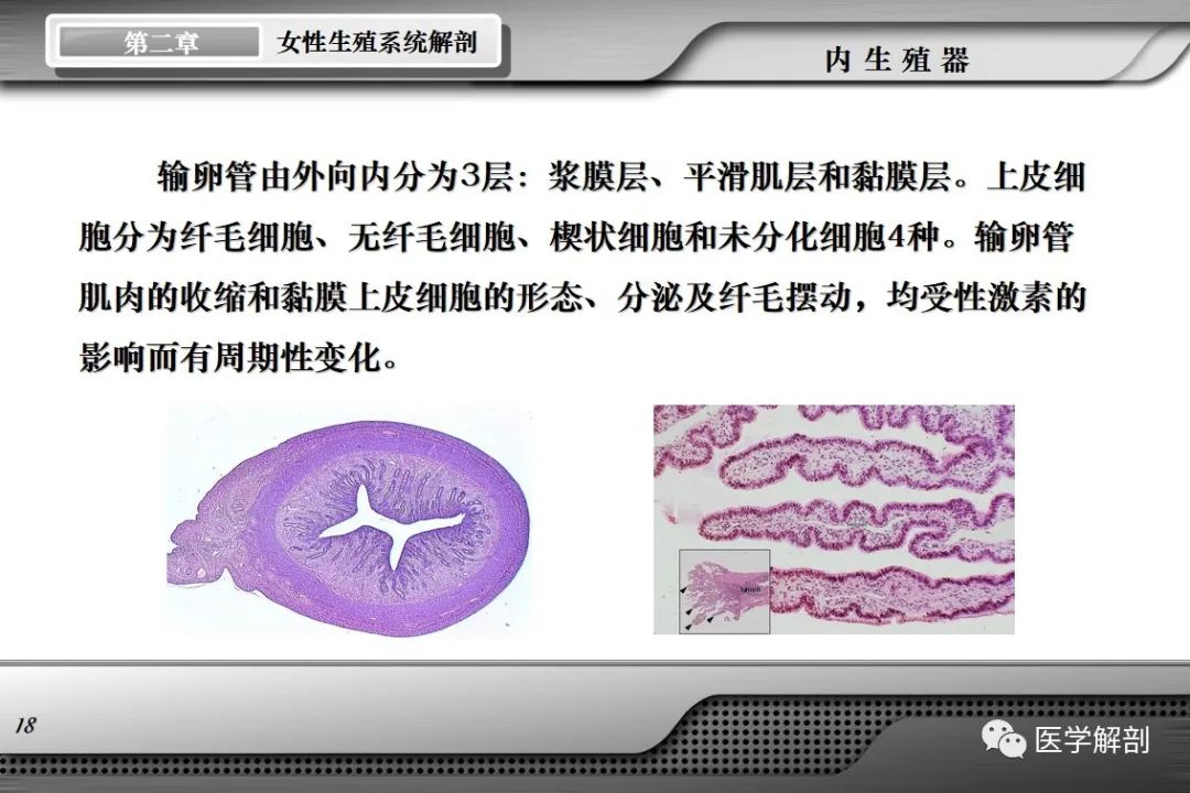 影像PPT - 【PPT】女性生殖系统解剖-17