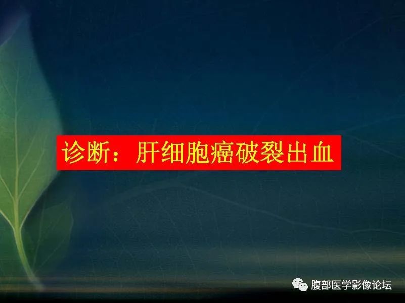 影像PPT - 【PPT】肝脏常见富血供病变读片-4