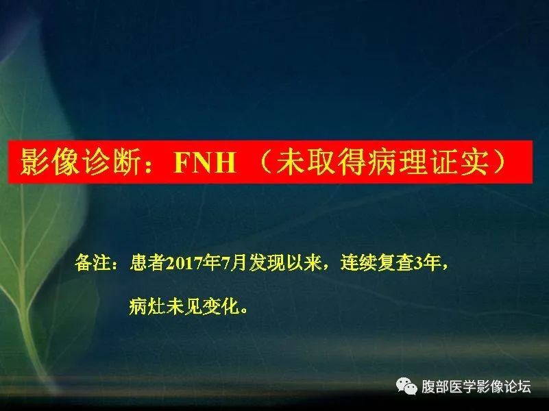 影像PPT - 【PPT】肝脏常见富血供病变读片-7