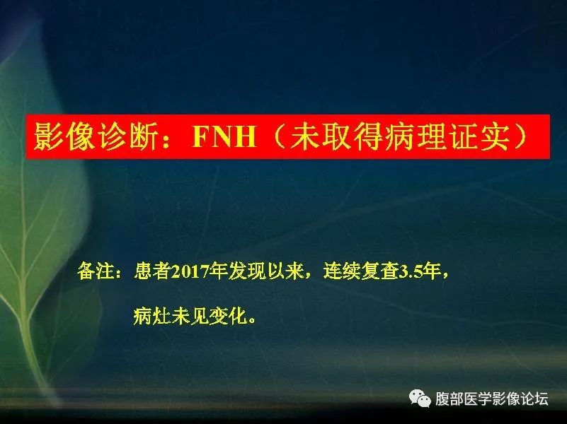 影像PPT - 【PPT】肝脏常见富血供病变读片-12