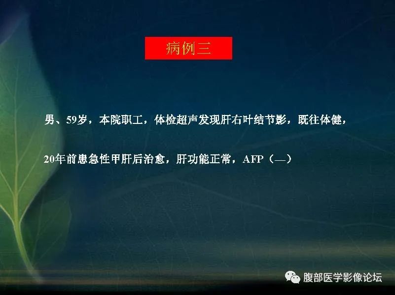 影像PPT - 【PPT】肝脏常见富血供病变读片-8