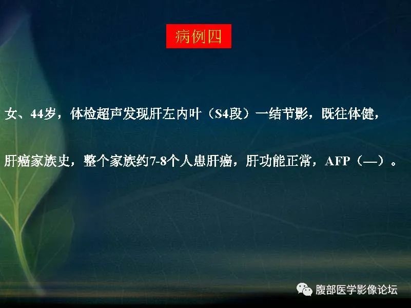 影像PPT - 【PPT】肝脏常见富血供病变读片-13
