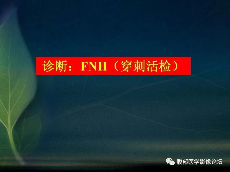 影像PPT - 【PPT】肝脏常见富血供病变读片-17
