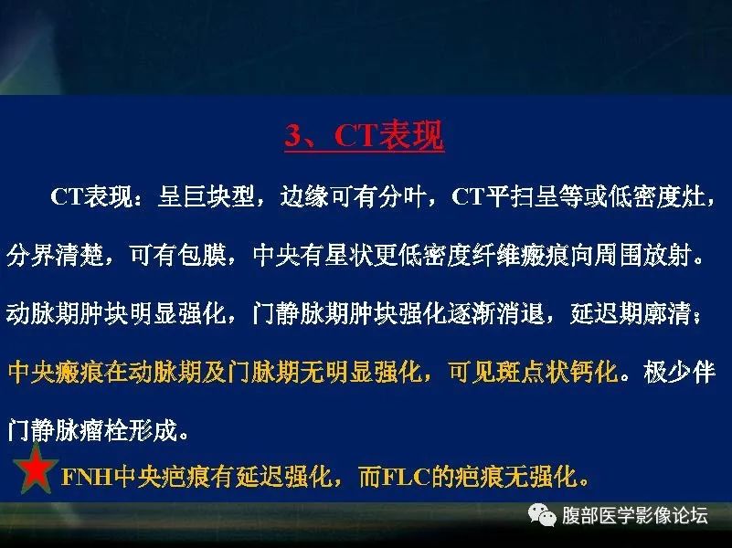 影像PPT - 【PPT】肝脏常见富血供病变读片-40