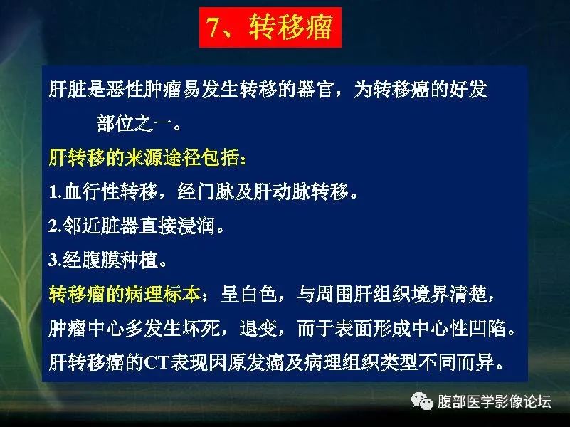 影像PPT - 【PPT】肝脏常见富血供病变读片-69