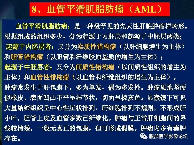 影像PPT - 【PPT】肝脏常见富血供病变读片-72