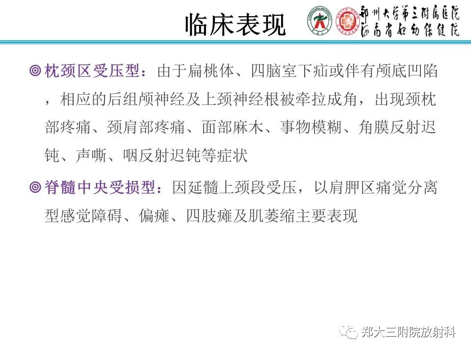 影像PPT - 【PPT】 Chiari畸形的影像诊断-10