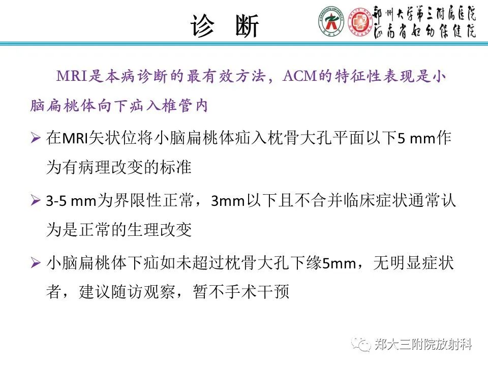 影像PPT - 【PPT】 Chiari畸形的影像诊断-12