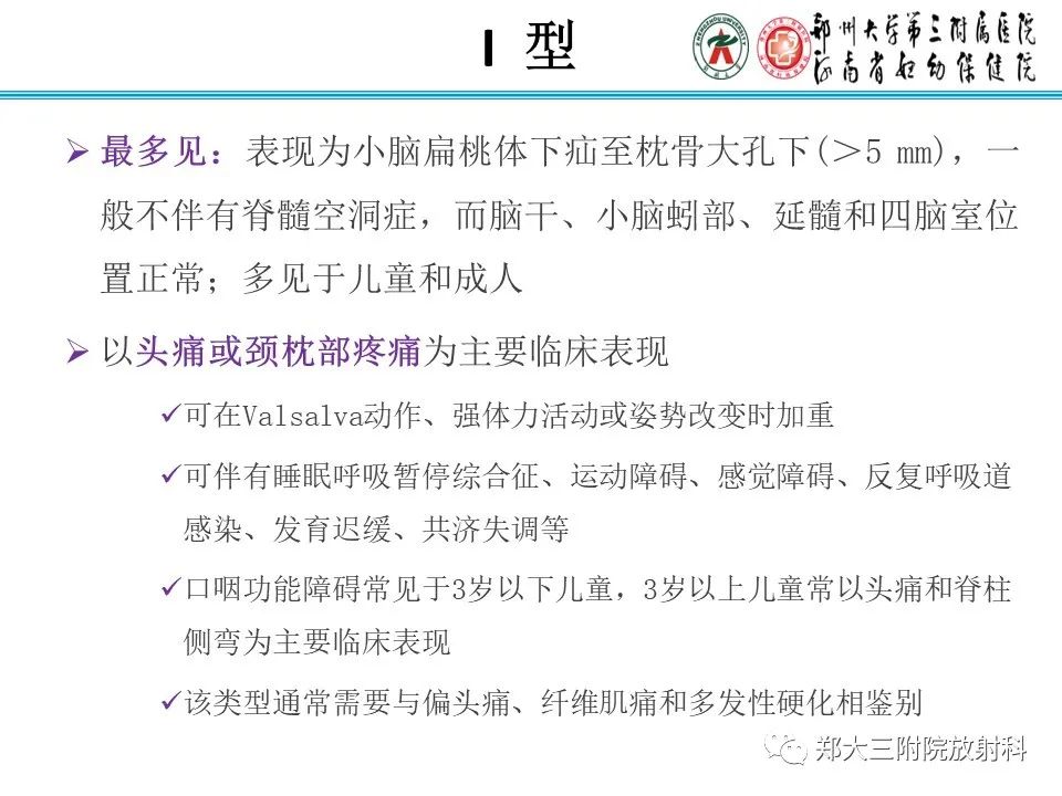 影像PPT - 【PPT】 Chiari畸形的影像诊断-15