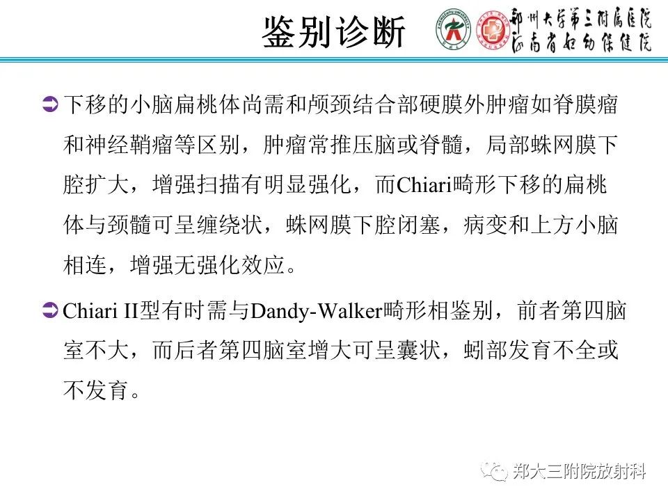 影像PPT - 【PPT】 Chiari畸形的影像诊断-29