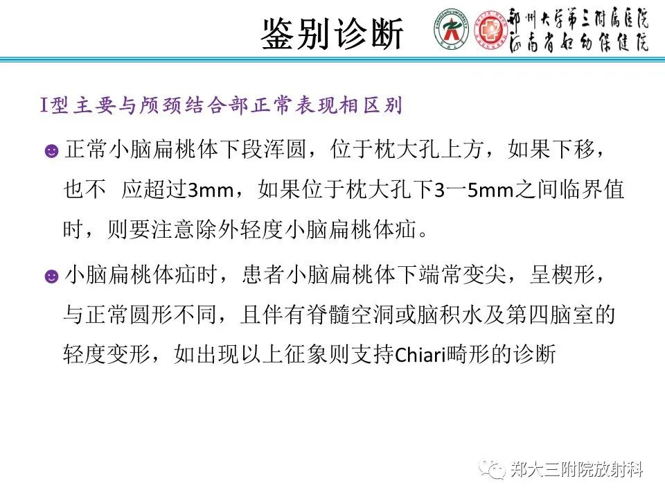 影像PPT - 【PPT】 Chiari畸形的影像诊断-28
