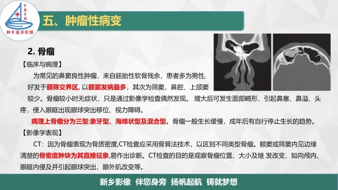 影像PPT - 【PPT】医学影像诊断学教材解读—鼻部疾病2-6