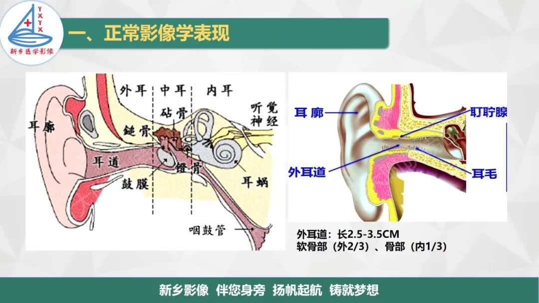 影像PPT - 【PPT】医学影像诊断学教材解读—耳部疾病-3