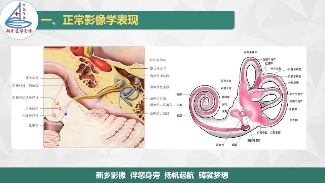 影像PPT - 【PPT】医学影像诊断学教材解读—耳部疾病-7