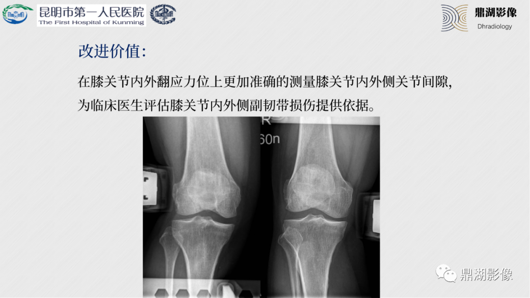 影像PPT - 【PPT】膝关节X线摄片技术改进-23