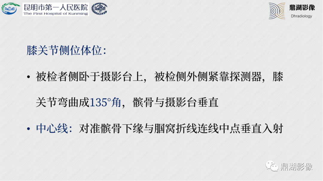 影像PPT - 【PPT】膝关节X线摄片技术改进-26