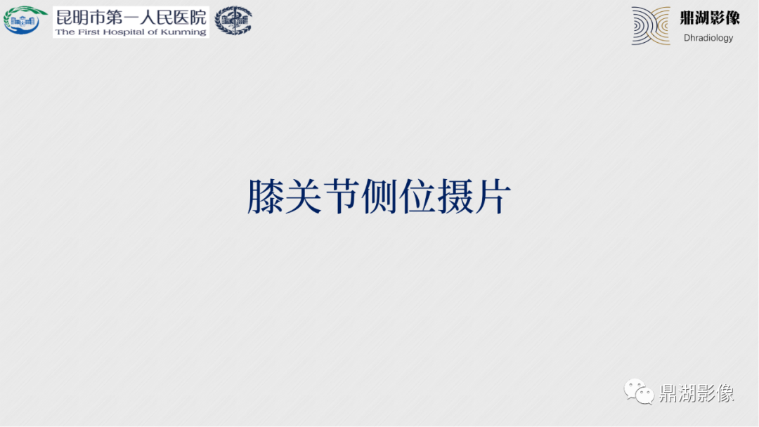 影像PPT - 【PPT】膝关节X线摄片技术改进-25